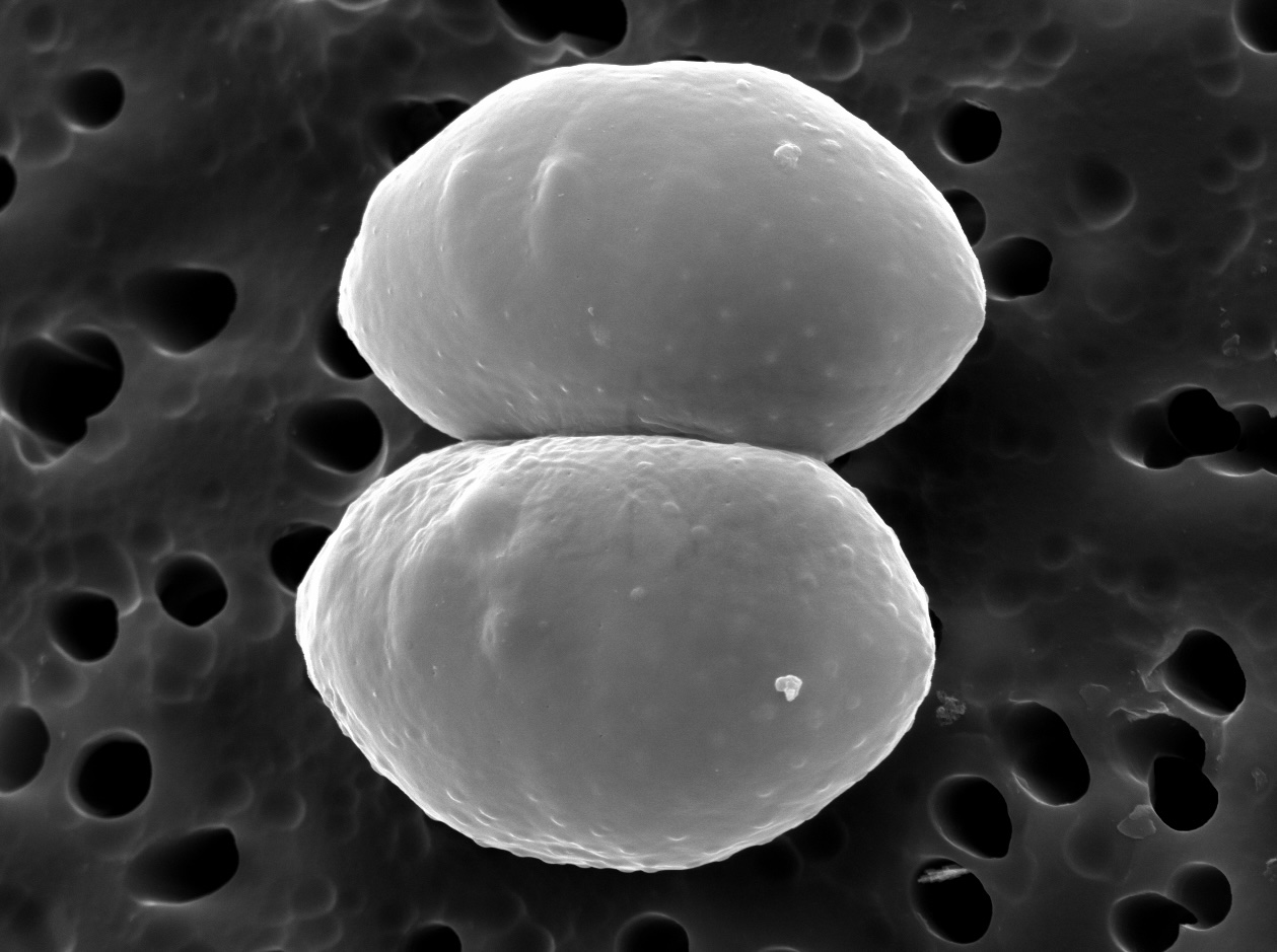 Cosmarium pseudoprotuberans